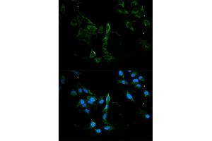 Immunofluorescence analysis of U2OS cells using MVP antibody. (MVP antibody)