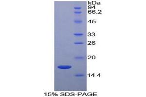 SDS-PAGE analysis of Cow RBP5 Protein.