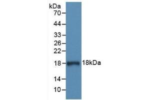 Western Blotting (WB) image for anti-Serpin Peptidase Inhibitor, Clade G (C1 Inhibitor), Member 1 (SERPING1) (AA 399-500) antibody (ABIN7426820)