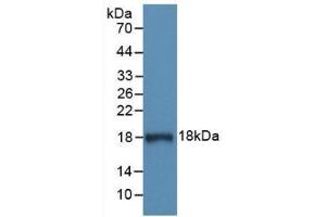 Detection of Recombinant C1INH, Human using Monoclonal Antibody to Complement 1 Inhibitor (C1INH) (SERPING1 antibody  (AA 399-500))