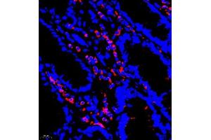 Immunofluorescence of paraffin embedded human colon using P4H (ABIN7074215) at dilution of 1:700 (400x lens) (HIF Prolyl Hydroxylase antibody)