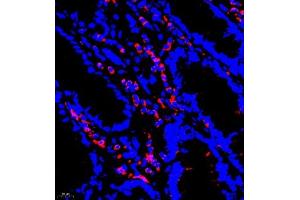 Immunofluorescence of paraffin embedded human colon using P4H (ABIN7074215) at dilution of 1:700 (400x lens)