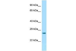 WB Suggested Anti-Hprt Antibody Titration: 1. (HPRT1 antibody  (C-Term))