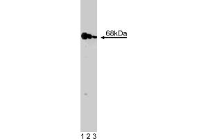 Western Blotting (WB) image for anti-Eukaryotic Translation Initiation Factor 2-alpha Kinase 2 (EIF2AK2) (AA 117-250) antibody (ABIN968165) (EIF2AK2 antibody  (AA 117-250))