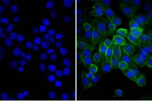 Human pancreatic carcinoma cell line MIA PaCa-2 was stained with Mouse Anti-Human CD44-UNLB and DAPI. (Donkey anti-Mouse IgG (Heavy & Light Chain) Antibody (FITC))