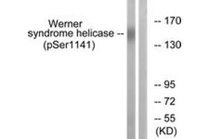 Western blot analysis of extracts from K562 cells treated with etoposide 25uM 24h, using Werner Syndrome Helicase (Phospho-Ser1141) Antibody. (RECQL2 antibody  (pSer1141))