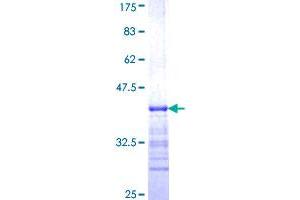 EIF3E Protein (AA 346-445) (GST tag)