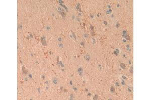Figure. (ALDOC antibody  (AA 34-281))