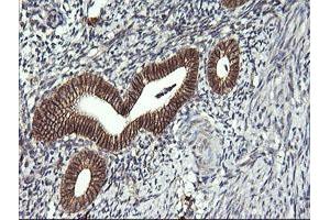 Immunohistochemistry (IHC) image for anti-T-cell surface glycoprotein CD1c (CD1C) antibody (ABIN2670676) (CD1c antibody)