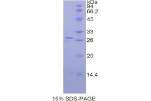 SDS-PAGE of Protein Standard from the Kit (Highly purified E. (ADRP ELISA Kit)