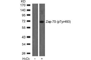 Image no. 2 for anti-zeta-Chain (TCR) Associated Protein Kinase 70kDa (ZAP70) (pTyr493) antibody (ABIN196887) (ZAP70 antibody  (pTyr493))