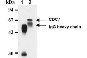 Western Blotting (WB) image for anti-Cell Division Cycle 7 (CDC7) antibody (ABIN487481) (CDC7 antibody)