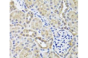 Immunohistochemistry of paraffin-embedded Mouse kidney using CGB7 Polyclonal Antibody at dilution of 1:100 (40x lens). (CGB7 antibody)
