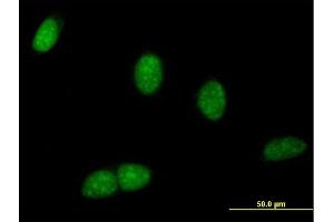 Immunofluorescence of purified MaxPab antibody to BRWD1 on HeLa cell. (BRWD1 antibody  (AA 1-120))