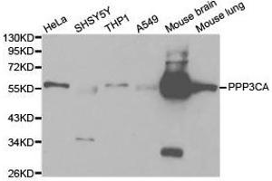 Western Blotting (WB) image for anti-Protein Phosphatase 3, Catalytic Subunit, alpha Isoform (PPP3CA) antibody (ABIN1874232) (PPP3CA antibody)