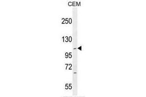 Western Blotting (WB) image for anti-Intraflagellar Transport 88 Homolog (IFT88) (AA 798-827), (C-Term) antibody (ABIN952829)