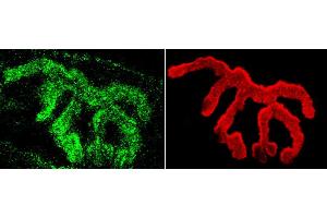 Immunohistochemistry analysis using Rabbit Anti-Piccolo Polyclonal Antibody . (Piccolo antibody  (APC))