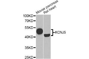 Western blot analysis of extracts of various cell lines, using KCNJ5 Antibody (ABIN1882359) at 1:1000 dilution. (KCNJ5 antibody)