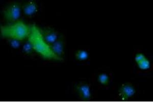 Image no. 3 for anti-Cancer/testis Antigen 1B (CTAG1B) antibody (ABIN1499891) (CTAG1B antibody)