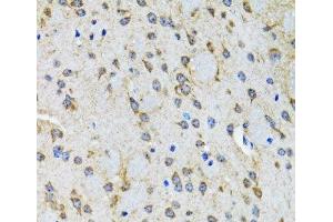 Immunohistochemistry of paraffin-embedded Rat brain using HTR2B Polyclonal Antibody at dilution of 1:100 (40x lens). (Serotonin Receptor 2B antibody)