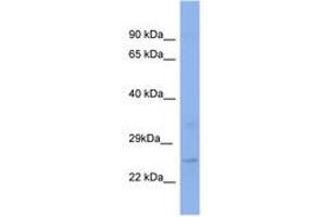 Image no. 1 for anti-Kruppel-Like Factor 16 (KLF16) (C-Term) antibody (ABIN6741674) (KLF16 antibody  (C-Term))