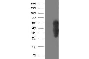 Western Blotting (WB) image for anti-WW Domain Containing Transcription Regulator 1 (WWTR1) antibody (ABIN1501762) (WWTR1 antibody)