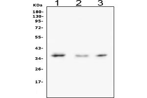 Western blot analysis of Galectin 8 using anti-Galectin 8 antibody (ABIN3043401).