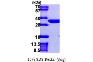 SDS-PAGE (SDS) image for Chloride Intracellular Channel 2 (CLIC2) (AA 1-247) protein (His tag) (ABIN667423)