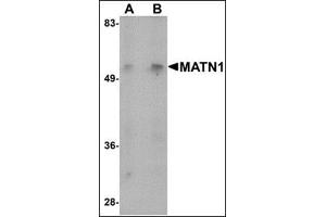 Western blot analysis of MATN1 in mouse liver tissue lysate with this product at (A) 1 and (B) 2 μg/ml.