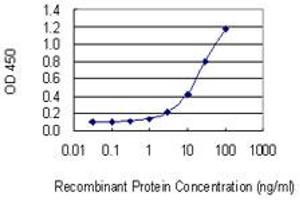Detection limit for recombinant GST tagged SLC30A5 is 0. (SLC30A5 antibody  (AA 1-118))