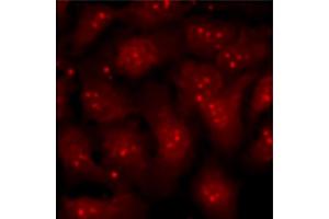 U2-OS cells stimulated with tetradecanoylphorbol acetate and treated with MEK and p38 inhibitors were stained with anti-Bmi1 followed by Goat Anti-Mouse Ig, Human ads-TXRD (Goat anti-Mouse Ig (Heavy & Light Chain) Antibody (Texas Red (TR)))