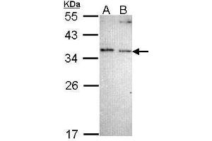 WB Image Sample (30 ug of whole cell lysate) A: A431 , B: H1299 12% SDS PAGE antibody diluted at 1:1000 (NOSIP antibody)