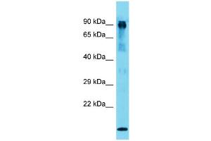 Host: Rabbit  Target Name: Mut  Sample Tissue: Mouse Muscle lysates  Antibody Dilution: 1.