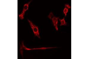 ABIN6274774 staining HuvEc cells by IF/ICC. (RPL26L1 antibody  (C-Term))