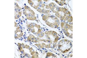 Immunohistochemistry of paraffin-embedded human stomach using ETFA antibody (ABIN5975750) at dilution of 1/100 (40x lens).