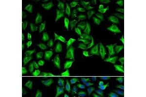 Immunofluorescence analysis of A549 cells using GDA Polyclonal Antibody (GDA antibody)