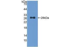 Western blot analysis of recombinant Human CDK9. (CDK9 antibody  (AA 104-315))