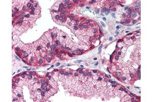 Anti-EGFR antibody IHC of human prostate. (EGFR antibody  (Internal Region))