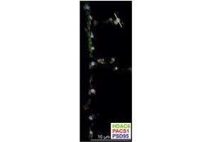 DIV18 neurons prepared from WT C57BL/6 mice were processed for confocal imaging to detect endogenous HDAC6 (green), PACS1 (red), and PSD95 (cat.