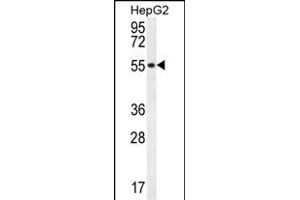 UXS1 antibody  (C-Term)