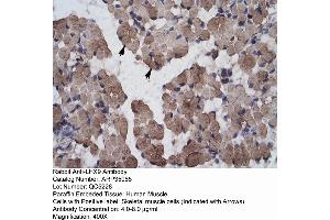 Human Muscle (LHX9 antibody  (C-Term))