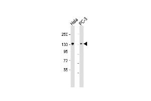 All lanes : Anti-KIF1B Antibody at 1:2000 dilution Lane 1: Hela whole cell lysate Lane 2: PC-3 whole cell lysate Lysates/proteins at 20 μg per lane. (KIF1B antibody)