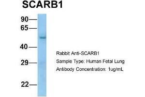 Host: Rabbit  Target Name: SCARB1  Sample Tissue: Human Fetal Lung  Antibody Dilution: 1. (SCARB1 antibody  (N-Term))