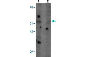 Western blot analysis of SHQ1 in human heart tissue with SHQ1 polyclonal antibody  at 1 ug/mL in (1) the absence and (2) the presence of blocking peptide. (SHQ1 antibody  (N-Term))