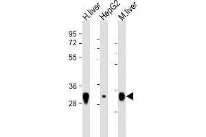 All lanes : Anti-TST Antibody (C-Term) at 1:8000 dilution Lane 1: human liver lysate Lane 2: HepG2 lysate Lane 3: mouse liver lysate Lysates/proteins at 20 μg per lane. (TST antibody  (AA 208-232))