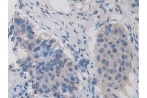 Immunohistochemistry (IHC) image for anti-Inter-alpha Trypsin Inhibitor, Heavy Chain 1 (ITIH1) (AA 507-819) antibody (ABIN7436564)