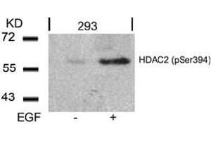 Image no. 3 for anti-Histone Deacetylase 2 (HDAC2) (pSer394) antibody (ABIN319237) (HDAC2 antibody  (pSer394))
