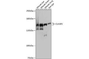 Western blot analysis of extracts of various cell lines, using CL antibody (ABIN1679249, ABIN3019015, ABIN3019016 and ABIN6220674) at 1:1000 dilution. (CLASP2 antibody  (AA 220-400))