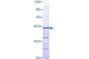 PYGO2 Protein (AA 1-110) (GST tag)