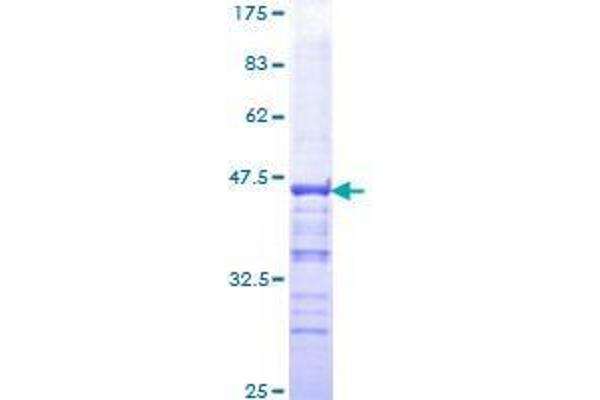 PYGO2 Protein (AA 1-110) (GST tag)
